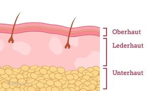 Wie entsteht Neurodermitis  NetDoktorde [upl. by Celie211]