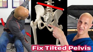 Fix Uneven Pelvis amp Hips in 60 Seconds  Dr Mandell [upl. by Deden310]