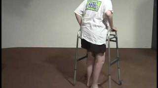 Abnormal Gait Exam  Neuropathic Gait [upl. by Anirba]