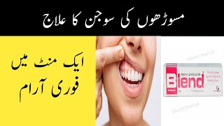 Masoro ki Sujan ka ilaj  Gum Swelling Treatment in Urdu amp Hindi [upl. by Cassandry]