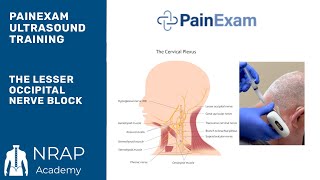 The Ultrasound Guided Lesser Occipital Nerve Block NRAP Academys Ultrasound Course excerpt [upl. by Manuel]