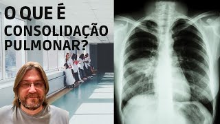 Você sabe o que é consolidação pulmonar [upl. by Puto]