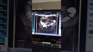 X ray  fluoroscopy procedure  fluoroscopy trending viral shorts arabic [upl. by Eanahc]