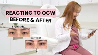 Reacting to My Patients Before and After Results eyelid QCW shonanbeautyclinic [upl. by Yenwat]