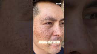 Top Dark Spot Creams You Cant Ignore darkspots darkspotsolution darkspotremover darkspotsonface [upl. by Aroel]