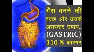 खाने के बाद नहीं होगी गैस  Stomach Gas Problem [upl. by Hairem968]