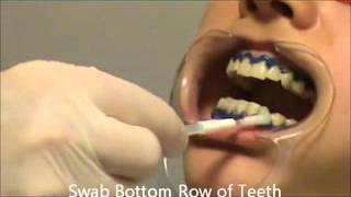 TEETH CLEANINGWHITENING POWER SWABS APPLICATION TUTORIAL [upl. by Gyatt]