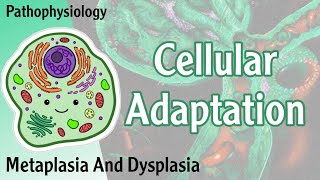 Pathophysiology  Cellular Adaptation  Metaplasia Dysplasia  Hani Laith شرح [upl. by Ahsiemal]