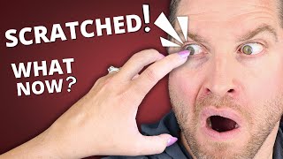 Scratched Eye  What You NEED To Know  Corneal Abrasion Symptoms Treatment [upl. by Nnylaf483]