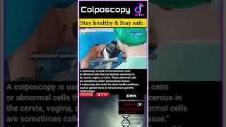 Colposcopy [upl. by Gilli]