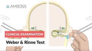 Weber and Rinne Test  Clinical Examination [upl. by Cordula]