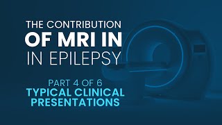 The contribution of MRI in Epilepsy  Part 4 Typical Clinical Presentations [upl. by Naltiac449]