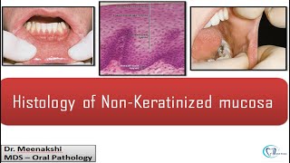 Nonkeratinized Stratified Squamous Epithelium [upl. by Melony]