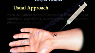 Carpal Tunnel Injection  Everything You Need To Know  Dr Nabil Ebraheim [upl. by Roselane142]