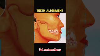 Teeth Alignment process shorts viral trending teeth alignment [upl. by Eiahpets]