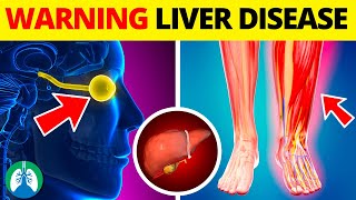 Top 10 Early Warning Signs of Liver Disease to NEVER IGNORE [upl. by Anewor413]