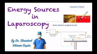 Energy Sources in Laparoscopy [upl. by Anitsyrhk]