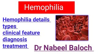 Hemophilia details lectures  Hematology [upl. by Anigue]