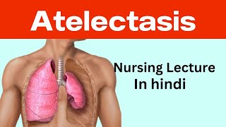 Atelectasis in hindi  cause pathophysiology symptoms management  collapsed lung [upl. by Tiffanle963]