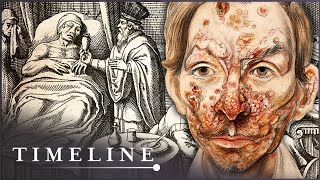 The True Terrors Of Tudor Medicine  Hidden Killers  Timeline [upl. by Wallache]