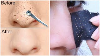 Easy DIY BLACKHEAD Remover Peel Off Mask  INSTANT RESULTS  Anaysa [upl. by Tatia]