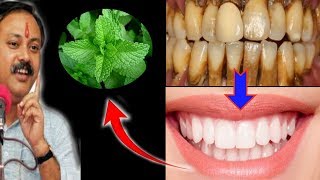 Magical Teeth whitening home remedy get whitening teeth at home in 5 minutes [upl. by Morris]