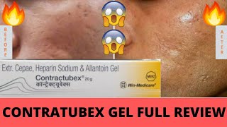 Contratubex Gel Full Review Effects and Side Effects Best for Skin Scars पुराने दाग गायब 🔥😃👍 [upl. by Hsakiv592]