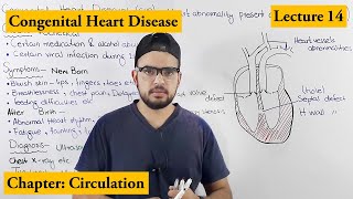 Congenital Heart Diseases Cardiovascular Disorders  Chapter Circulation video  14 [upl. by Feinleib]