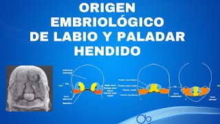 Origen Embriológico de Labio y Paladar Hendido [upl. by Olemrac]