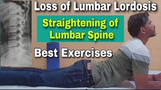 Loss of Lumbar Lordosis Exercises in Hindi  Straightening of Lumbar Spine  Spine Curvature [upl. by Aseefan625]