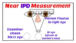 Near Inter Pupillary Distance Measurement [upl. by Enovaj]