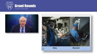 Mayo Clinic Grand Rounds – Robotic Approach to Mitral Valve Repair Mayo Clinic Experience [upl. by Annyrb985]