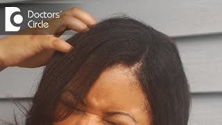 Reasons for itchy scalp and how to treat it  Dr Rasya Dixit [upl. by Fredra]