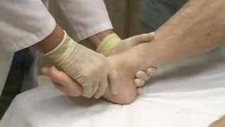 Dislocation Reduction Ankle sample  proceduresconsultcom [upl. by Derwon]