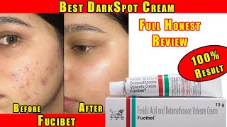 Face dark spot removal cream  Best cream for dark spots  Fucibet dark spot cream  Fucibet uses [upl. by Omsoc943]