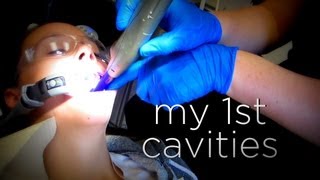 MY FIRST CAVITIES [upl. by Bertina903]