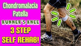 Chondromalacia PatellaRunner’s Knee SELF REHAB 3 EASY STEPS  Dr Wil amp Dr K [upl. by Warfourd333]