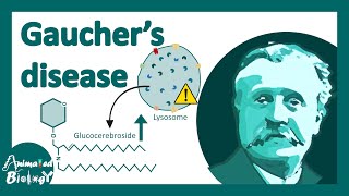 Gauchers disease  classification symptoms pathology of Gauchers disease [upl. by Roberta]