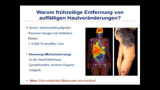 Hautkrebsscreening Wann und wie oft [upl. by Irihs]