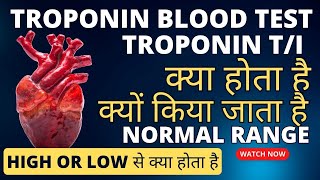 Troponin test in hindi  Troponin t test  troponin test normal range  troponin i test [upl. by Vidovik]