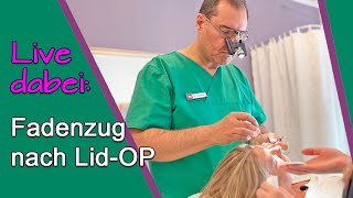 AugenlidOP – Erfahrungsbericht Fäden ziehen nach SchlupflidOP bei Dr Günther Düsseldorf [upl. by Ailasor]