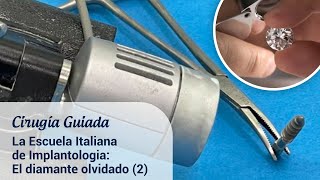 La escuela italiana de Implantología El diamante olvidado 2 cirugíaguiada [upl. by Greenland201]