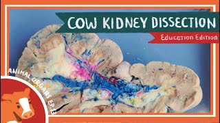 Kidney Dissection  A Man of My Kidney EDU [upl. by Homere]