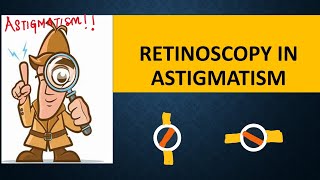 RETINOSCOPY in ASTIGMATISM  Break intensity  brightness and skew  Straddling [upl. by Barny]