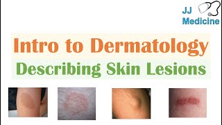 Introduction to Dermatology  The Basics  Describing Skin Lesions Primary amp Secondary Morphology [upl. by Joachima]