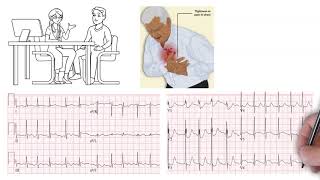 SOBRE O CURSO INTENSIVO DE ECG [upl. by Aillimac]