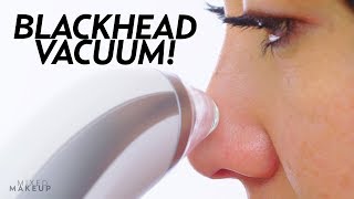 I Tried a Blackhead Remover Pore Vacuum  Beauty with Susan Yara [upl. by Lennej]