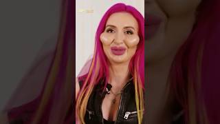 Shocking Celebrity Cosmetic Surgery Disasters celebritynews [upl. by Lennard]