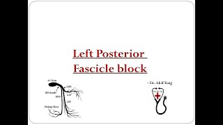 Left Posterior Fascicular Block  Dr Akif Baig [upl. by Blodget]