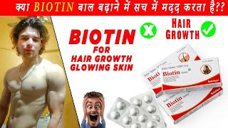 Refollium biotin reviewDoes Biotin Work For Hair Growth क्या Biotin बाल बढ़ाने में मदद करता है [upl. by Chrissy]